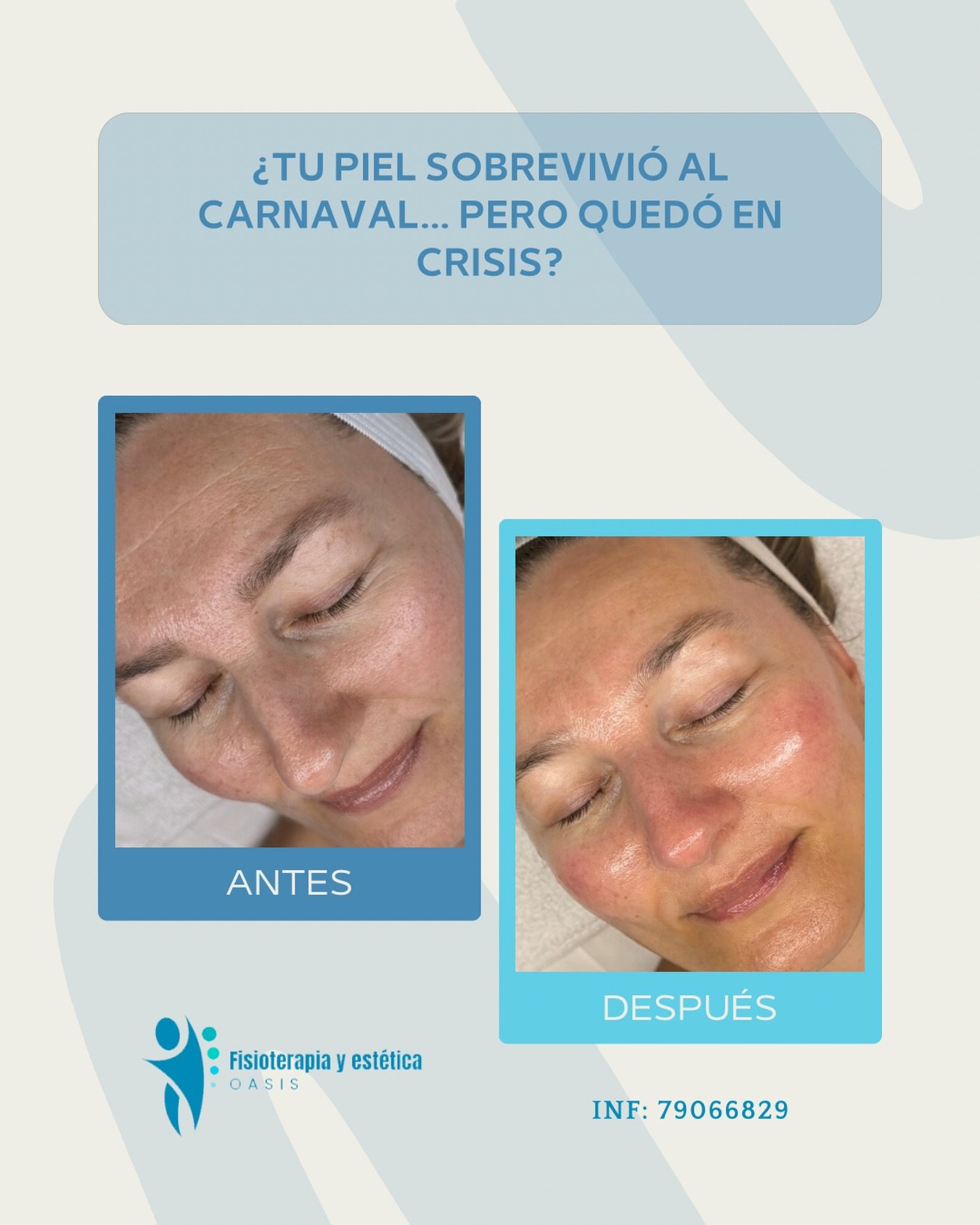 Tratamiento estético en Oasis Fisioterapia, Santa Cruz de la Sierra